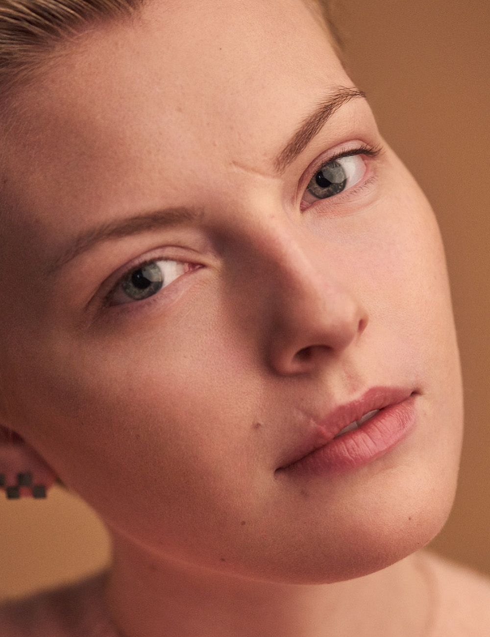 Glam Aesthetics – Islamabad’s Trusted Clinic for Scar Removal