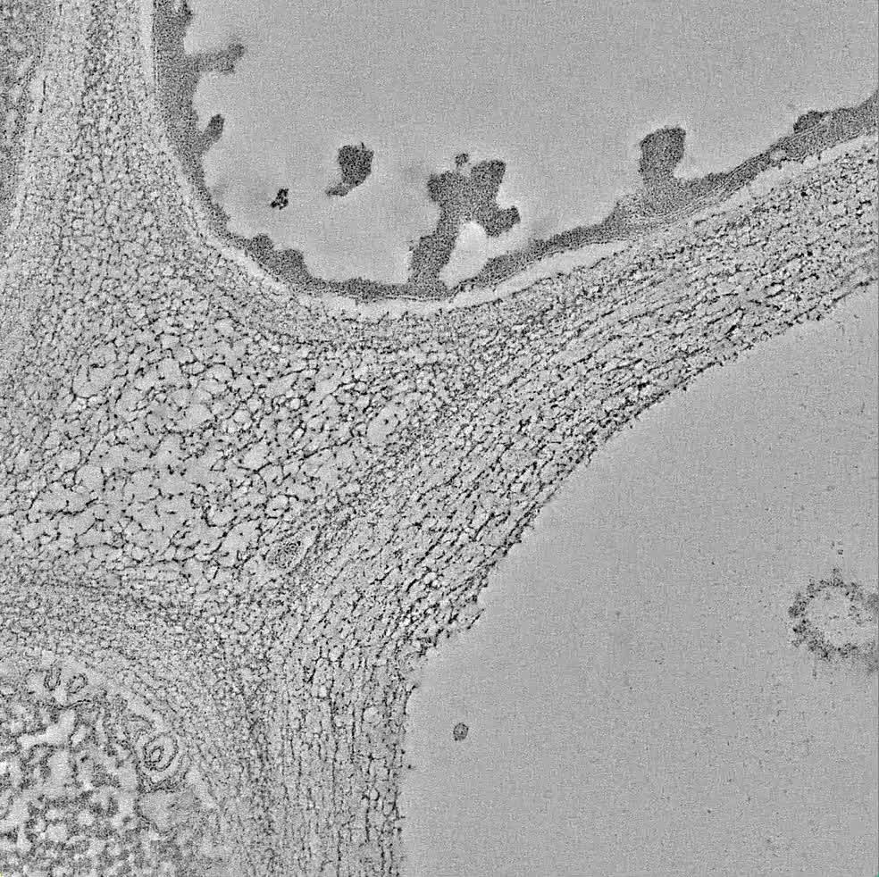 Cryo-Electron Microscopy: A Powerful Tool for Visualizing the Structure of Macromolecules