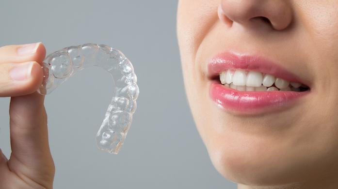 Clear Aligners - Are They Right for You?