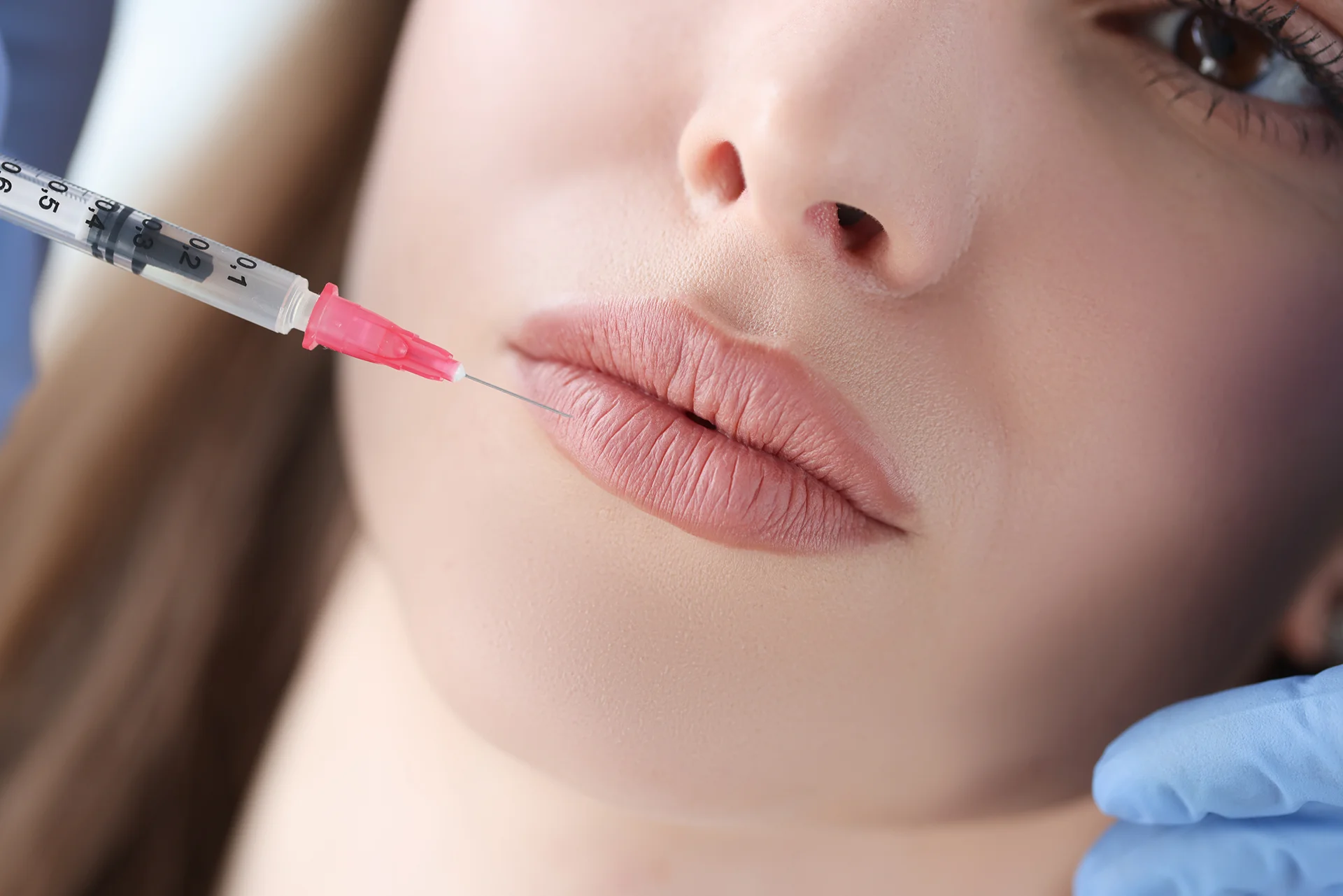 Are Russian Lip Fillers Safe for All Skin Types?