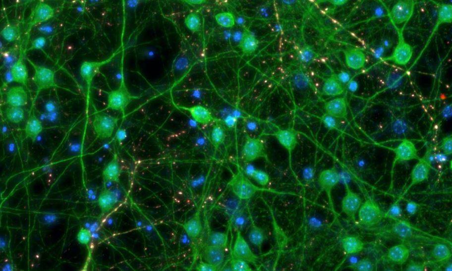 Targeting Amyloid and Tau Proteins: Current and Emerging Therapies for Alzheimer’s
