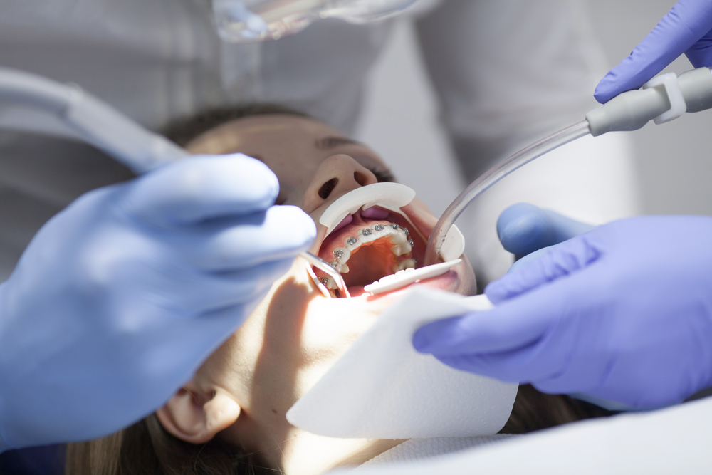 Restore Your Smile with Dental Implants in Hamilton