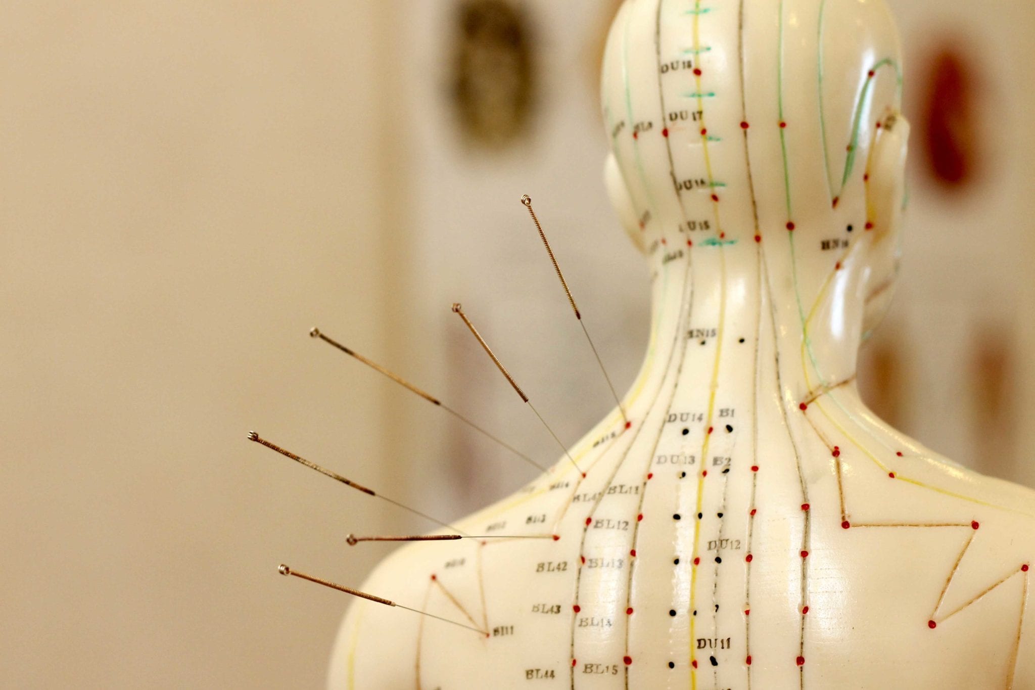 Acupuncture in Toronto: Natural Healing at King Thai Massage Health Care Centre