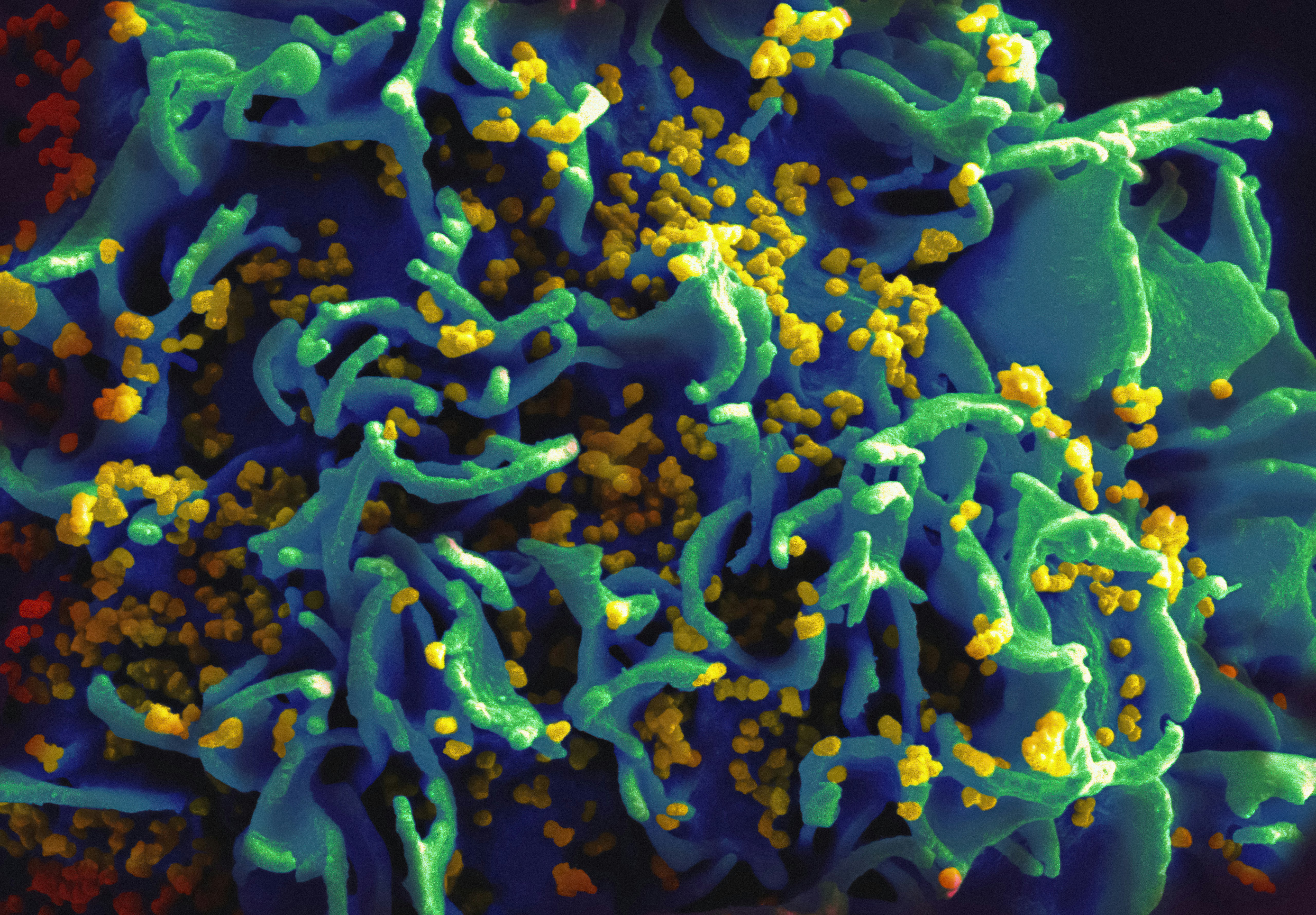 Comment se procurer de la doxycycline ?