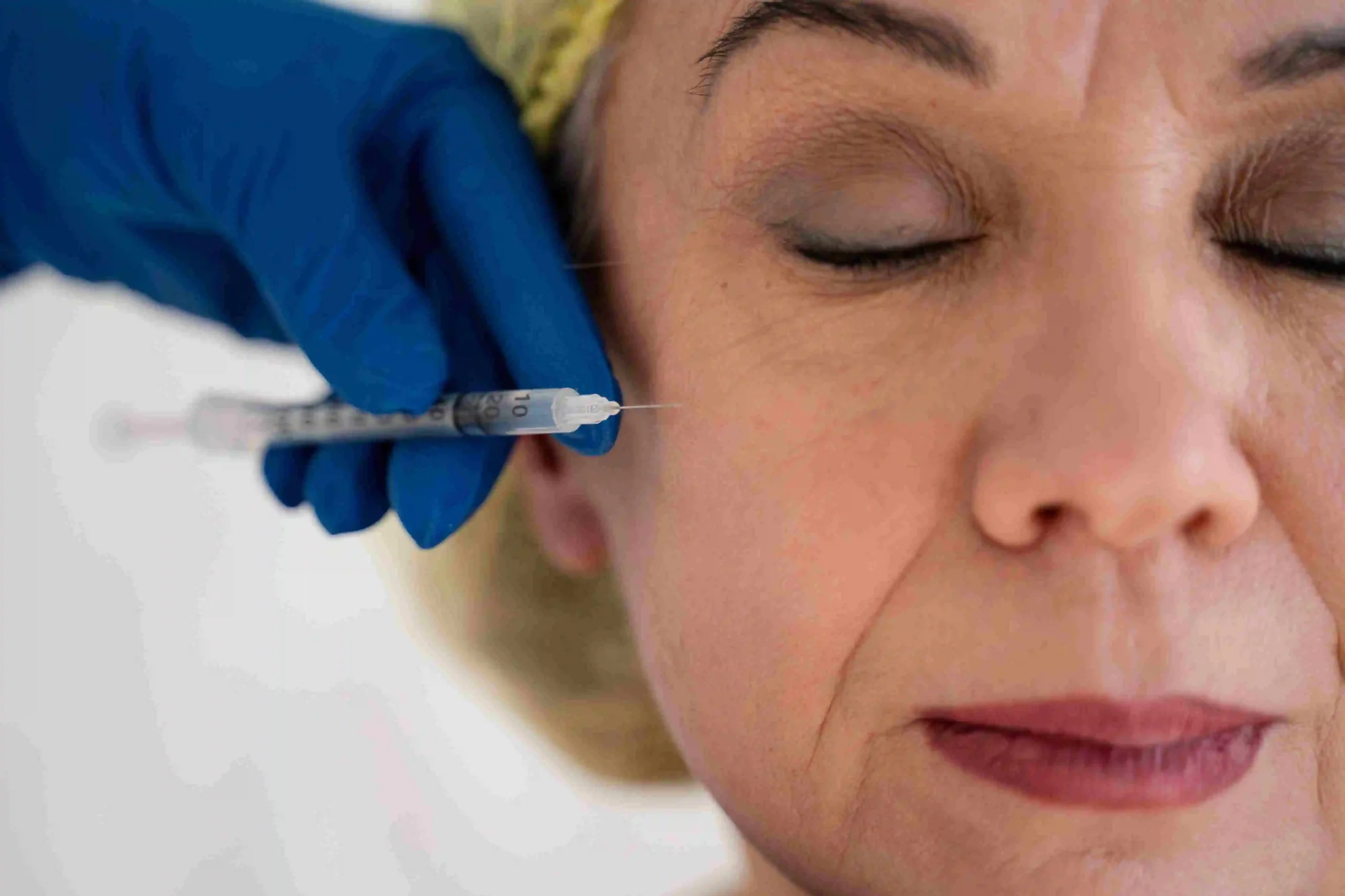 Is Botox Haram?