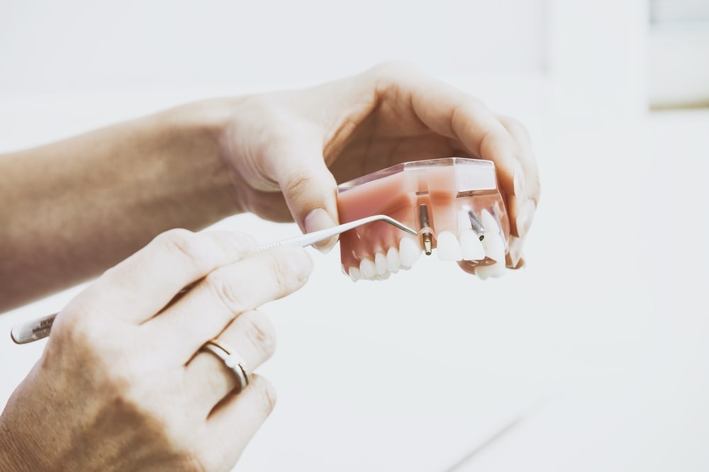 Dentures Brisbane North | Denturesquare.com