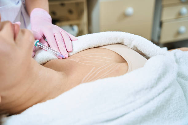 What to Expect from Fat Dissolving Needle Treatment in Dubai