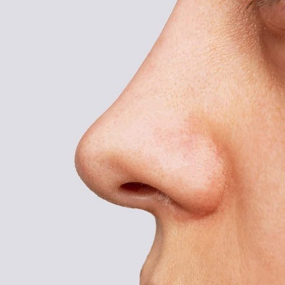 جراحة تجميل الأنف: نصائح للتعافي معتمدة من الخبراء