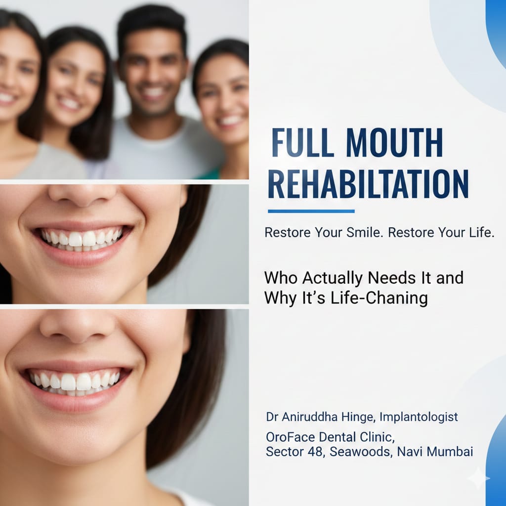 What Is Full Mouth Rehabilitation?