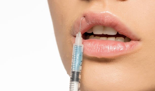 Permanent Fillers Removal: Avoiding Common Mistakes