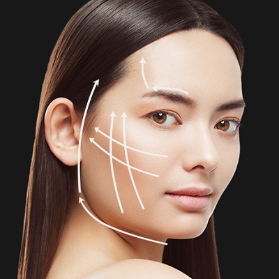 Can Silhouette Soft Lift Help Restore Lost Facial Volume?