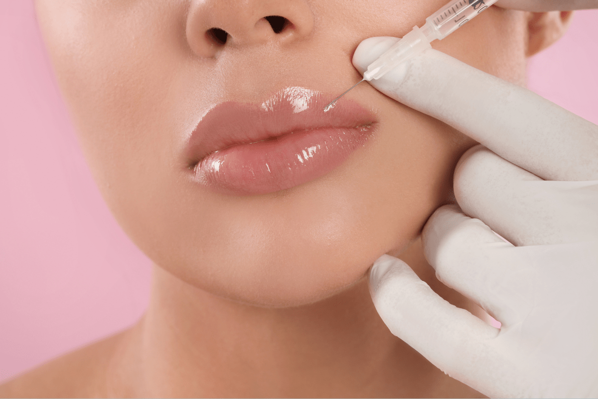 What Makes Lip Filler a Popular Lip Enhancement?