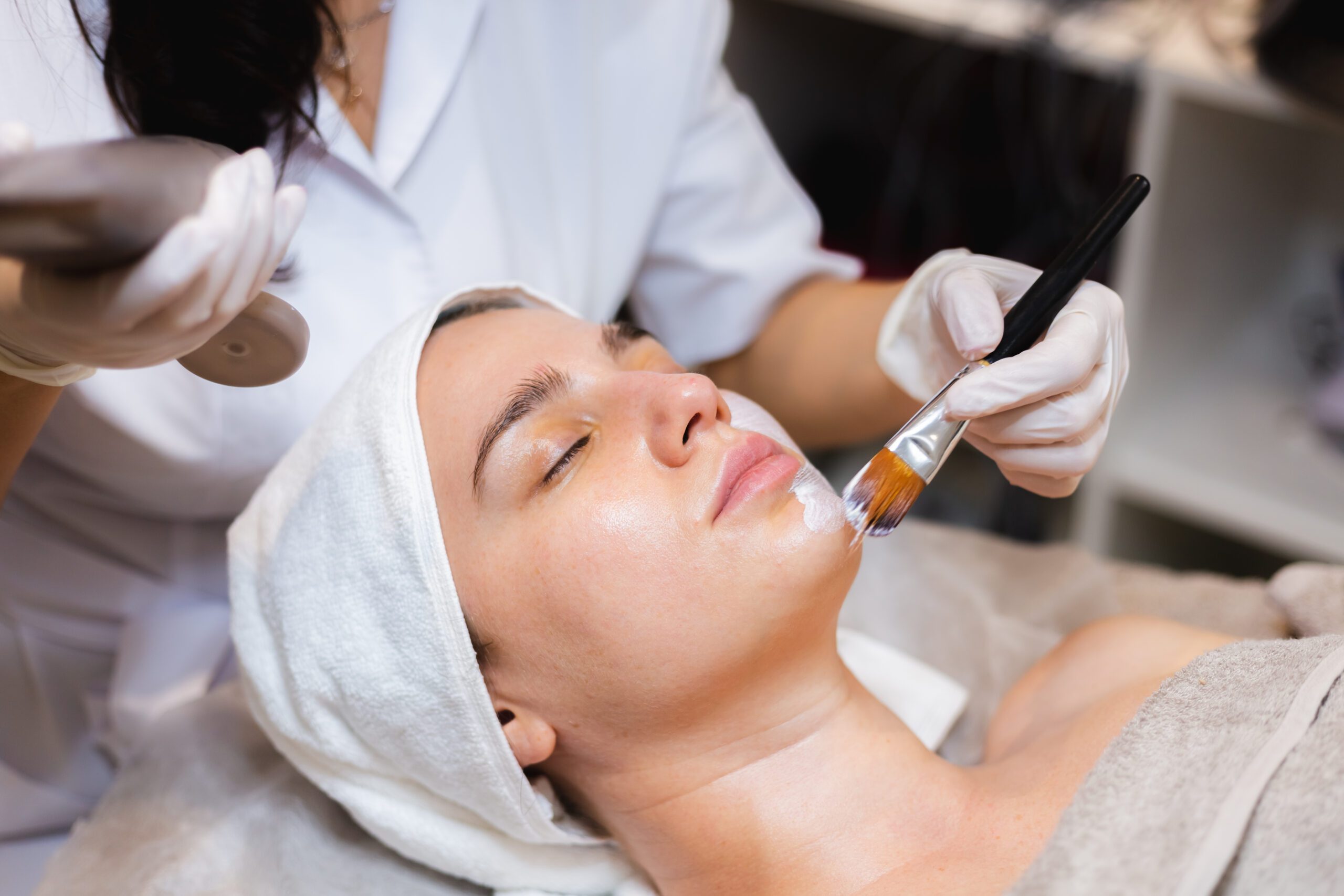 What Is Cosmelan Peel and How Does It Treat Melasma?
