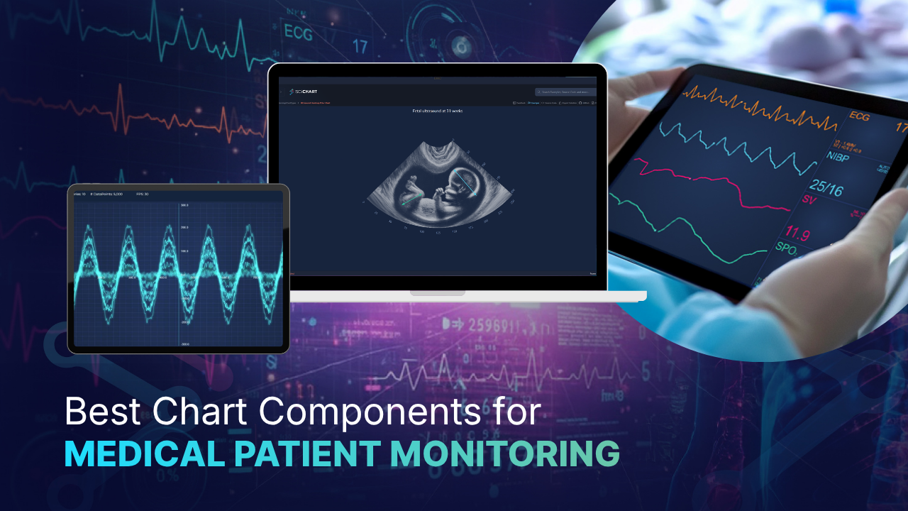 Best Chart Components for Medical Patient Monitoring Systems