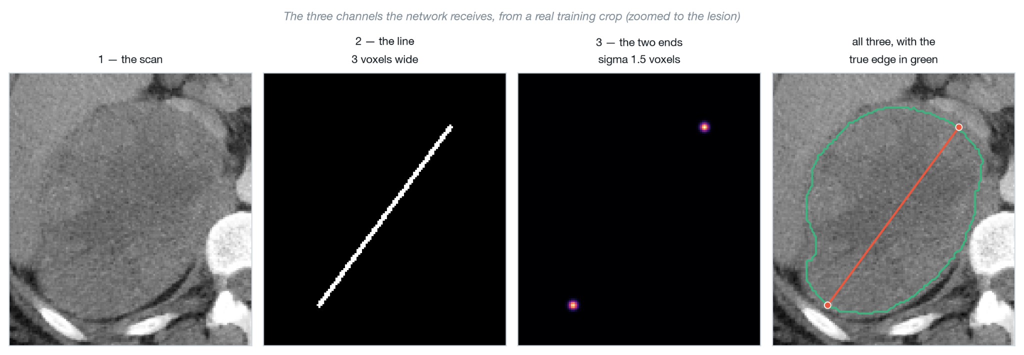 CT image and the two RECIST prompt channels used as input to Lumina: the RECIST line and endpoint heatmap.